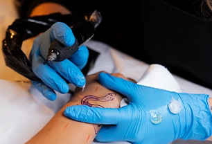 Best Tattoo Removal Singapore